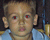 Better Red Eye Repair