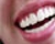 Whiter teeth