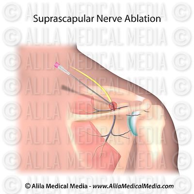 Alila Medical Media | Chiropractic Images & Videos Alila Medical Media | Chiropractic Images & Videos