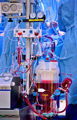 Heart/lung (Perfusion) machine detail