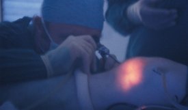 Arthroscopy, note the light coming through the skin as well as lining of the knee joint.