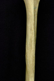 Humerus, septal aperture
