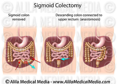Alila Medical Media | Digestive System Images