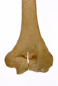 Humerus, septal aperture
