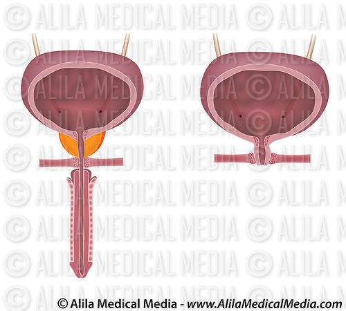 Alila Medical Media | Male versus female urinary system, unlabeled