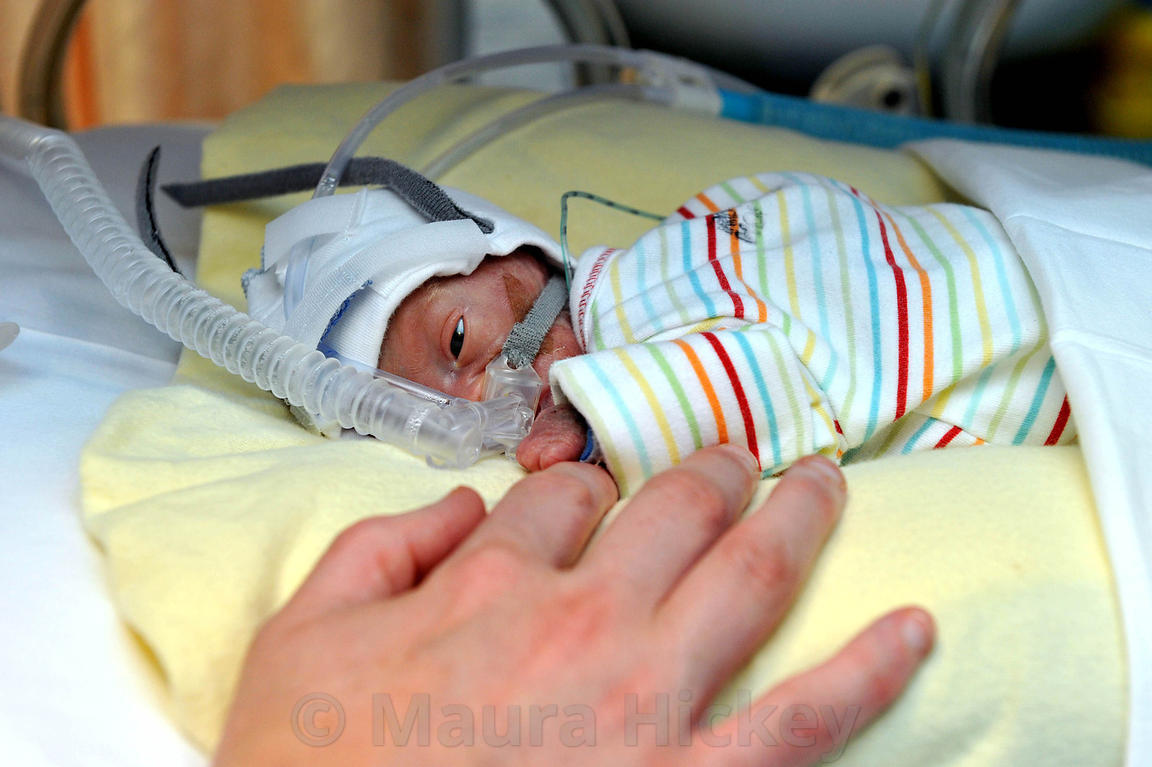 Baby Stephen born at the Rotunda Hospital 13 weeks early weighing 1 lb 2 oz.