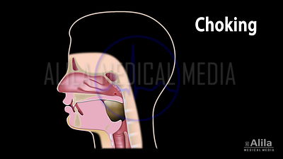 Choking, animação