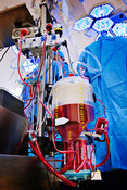 Heart/lung (Perfusion) machine detail