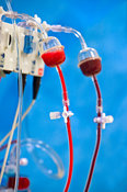 Detail of Heart/lung (Perfusion) machine