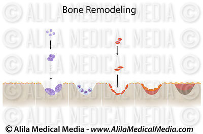 Bone remodeling cycle unlabeled