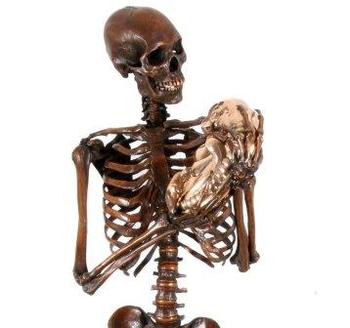 Bjorn Sjoling skeleton