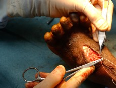 SL0312-orthosurgery19-jf