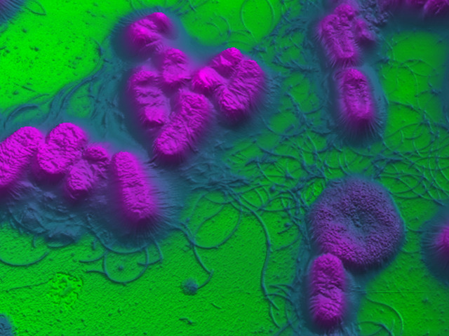 Bacterial Warfare