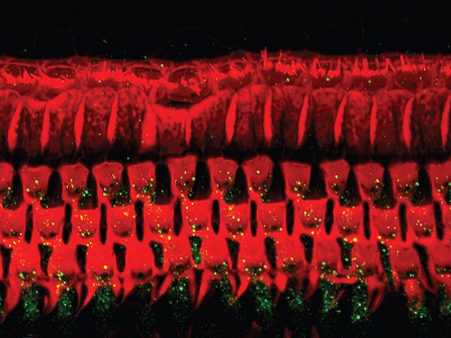 Hair Cell Roots