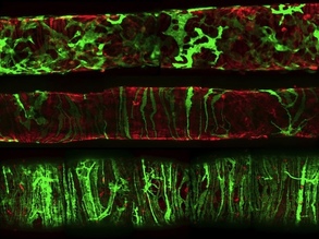 Lymph Contract Holders