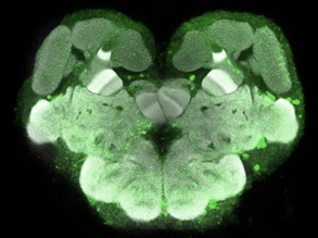 Social Workers' Brains