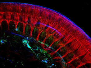 Window of Regeneration