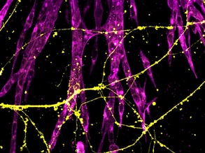 Cancer Nerves Close-up