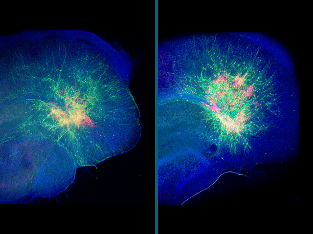 Migrating Neurons