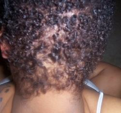 Going Natural - Brunette, 4a, Very short hair styles, Kinky hair, Afro, Readers, Female, Curly hair hairstyle picture