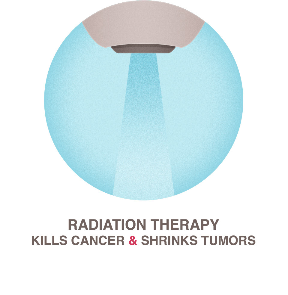 Radiation Therapy - National Breast Cancer Foundation