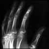 My hand, x-rayed