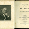 A Treatise on the Blood, Inflammation, and Gun-shot Wounds