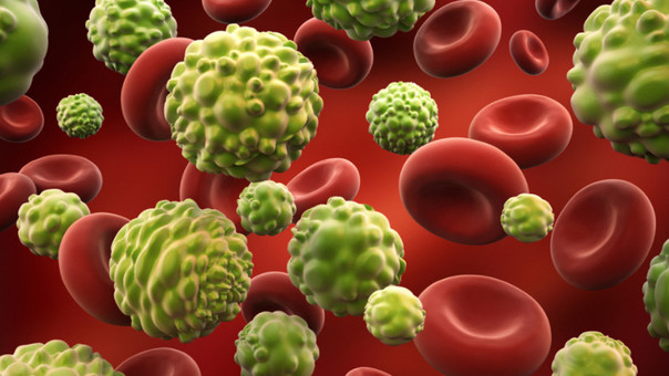 La mayoría de las muertes por cáncer se producen por la metástasis de un tumor en el pulmón y el hígado.