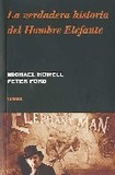 La verdadera historia del hombre elefante's poster (Peter Ford)