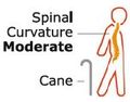 The Potential Research Impact of Patient Reported Outcomes on Osteogenesis Imperfecta