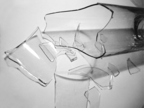 Birth and Other Fatalities