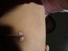 What is this skin problem thing?