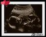 How many weeks old is the baby in this ultrasound?
