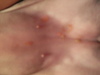 Little Green Bumps