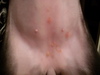 Little Green Bumps