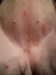 Little Green Bumps