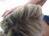 Hair Problems