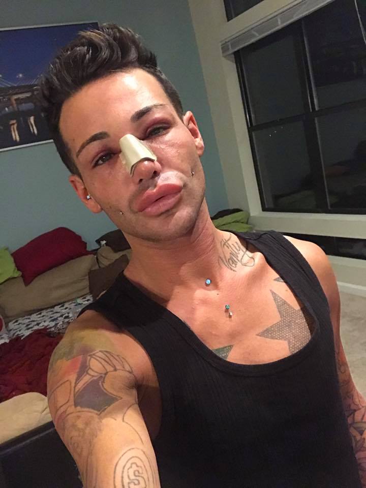 Homem faz cirurgias plásticas desde os 15 anos, mas não se diz viciado