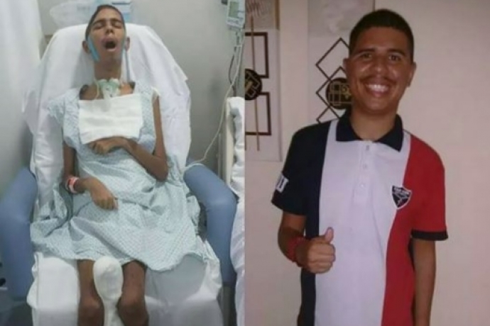 Ele tinha apenas 5 por cento de chance de sobreviver