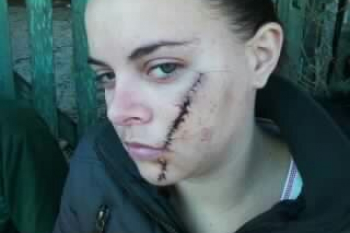 Como perdoar alguém que cortou o seu rosto?