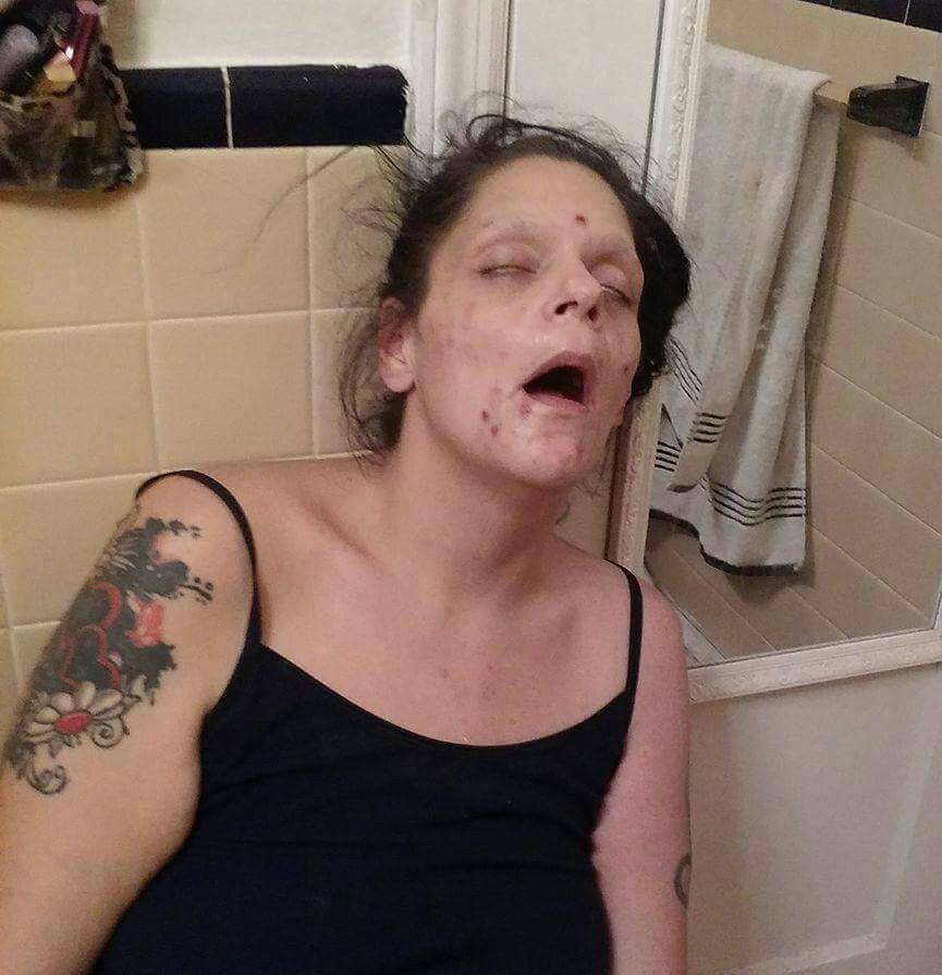Ex-usuária de heroína mostra fotos de quando estava sob efeito da droga