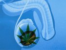 Marijuana Use Linked to Testicular Cancer ... That's a Bummer, Man