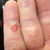 Image_thumb