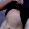 Ab_thumb