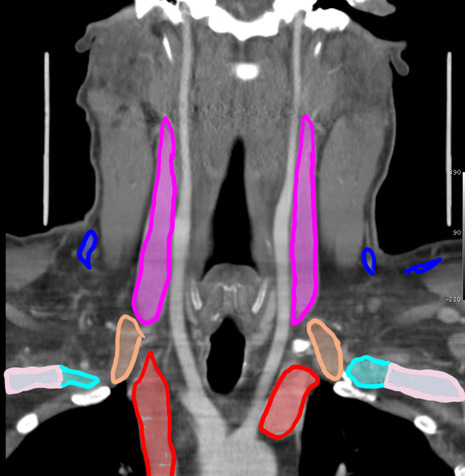 Chest CT Anatomy (Part 2) for Radiology Residents