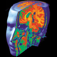 Piece image