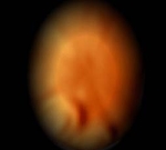 Piece image