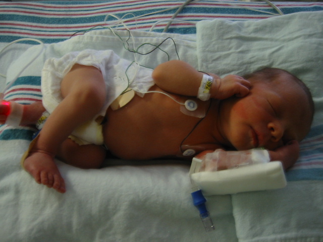 Caption: William in the NICU, Credit: Matt Clark