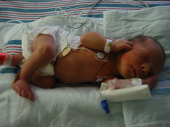 Caption: William in the NICU, Credit: Matt Clark