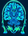 Brain_small